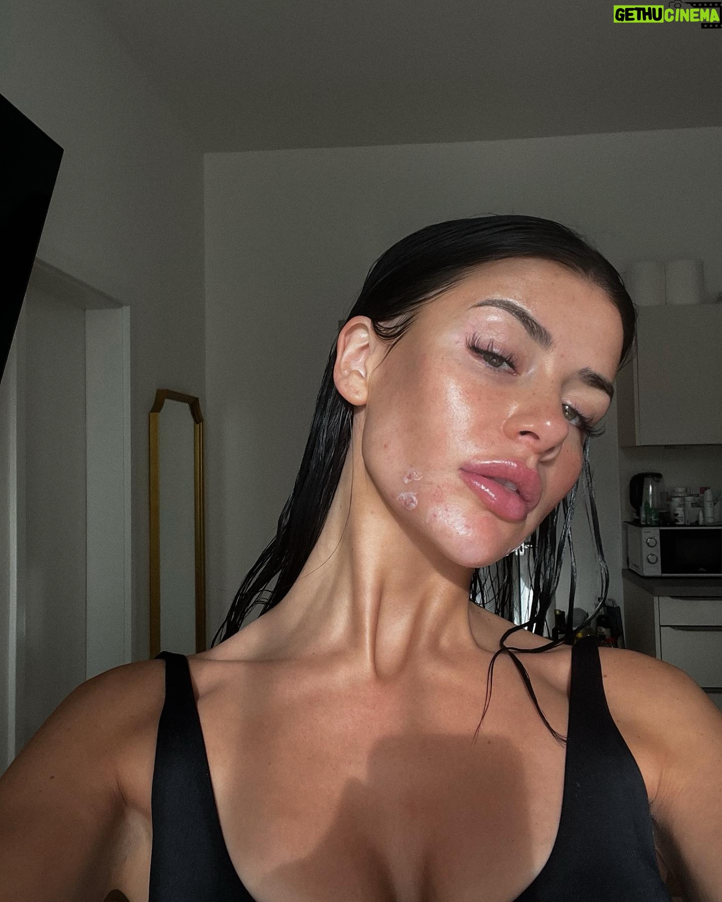 Dominique Alagia - 84.3K Likes - skin
real, raw, beautiful skin