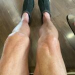 Dot-Marie Jones Instagram - I haven’t post anything about my knee replacement. I know my girl @bridgettcjones had but wanted to as well. My knee was a mess and this was the 8th surgery on my left one. I think I got my miles out of it. 9-12-23 was surgery! Have had some very bad days but slowly getting better! Thank you @bridgettcjones for being an amazing nurse and taking good care of me . I love you forever and always. I made that fancy cup and stuff holder for my Walker!!! Jealous 😉love y’all! I’ll keep y’all up to date! Today is day 8. Ya don’t count the day ya had the surgery cause ya don’t!!!