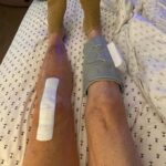 Dot-Marie Jones Instagram - I haven’t post anything about my knee replacement. I know my girl @bridgettcjones had but wanted to as well. My knee was a mess and this was the 8th surgery on my left one. I think I got my miles out of it. 9-12-23 was surgery! Have had some very bad days but slowly getting better! Thank you @bridgettcjones for being an amazing nurse and taking good care of me . I love you forever and always. I made that fancy cup and stuff holder for my Walker!!! Jealous 😉love y’all! I’ll keep y’all up to date! Today is day 8. Ya don’t count the day ya had the surgery cause ya don’t!!!