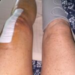 Dot-Marie Jones Instagram - I haven’t post anything about my knee replacement. I know my girl @bridgettcjones had but wanted to as well. My knee was a mess and this was the 8th surgery on my left one. I think I got my miles out of it. 9-12-23 was surgery! Have had some very bad days but slowly getting better! Thank you @bridgettcjones for being an amazing nurse and taking good care of me . I love you forever and always. I made that fancy cup and stuff holder for my Walker!!! Jealous 😉love y’all! I’ll keep y’all up to date! Today is day 8. Ya don’t count the day ya had the surgery cause ya don’t!!!