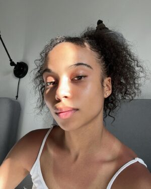 Eden Cupid Instagram - yes she is burned, no it does not hurt, but she’s fresh faced n happy to be here :) 💓