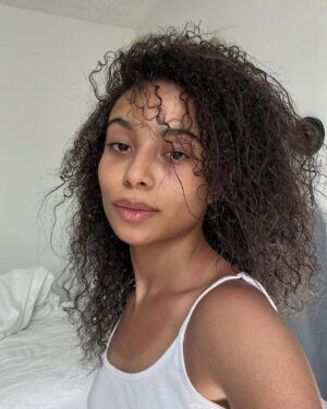 Eden Cupid Instagram - yes she is burned, no it does not hurt, but she’s fresh faced n happy to be here :) 💓