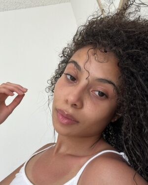 Eden Cupid Instagram - yes she is burned, no it does not hurt, but she’s fresh faced n happy to be here :) 💓
