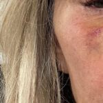 Eileen Davidson Van Patten Instagram - Don't mess with me on the pickleball court! And she was my partner! @lisaawilliams3 love you and so sorry for the shiner🥹