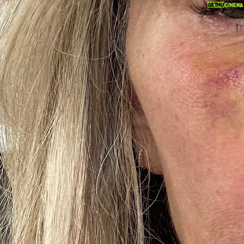 Eileen Davidson Van Patten Instagram - Don't mess with me on the pickleball court! And she was my partner! @lisaawilliams3 love you and so sorry for the shinerš„¹