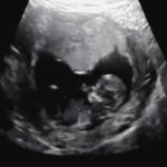 Elle Fowler Instagram - Feeling so incredibly thankful 🙌🏻 Watch my last 2 videos for all the details! Swipe to see little one sitting in a ❤️