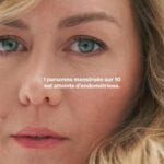Enora Malagré Instagram - Cette maladie est « toujours là » , on en guérit toujours pas et pourtant nous sommes environ 190 millions à en souffrir dans le monde . Il faut agir ! @infoendometriose @ceciletogni @andrea.brscn @charlyne.ubk . Pour toutes celles qui souffrent... vous n’êtes pas seules . Nous sommes ensemble 💪🏼.🎗️