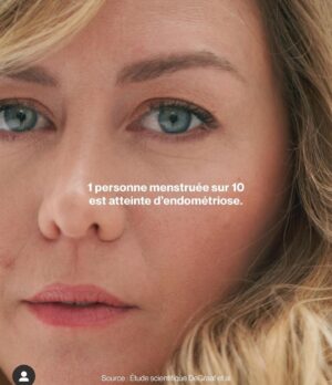 Enora Malagré Instagram - Cette maladie est « toujours là » , on en guérit toujours pas et pourtant nous sommes  environ 190 millions à en souffrir dans le monde . Il faut agir ! @infoendometriose @ceciletogni @andrea.brscn @charlyne.ubk . Pour toutes celles qui souffrent... vous n’êtes pas seules . Nous sommes ensemble 💪🏼.🎗️