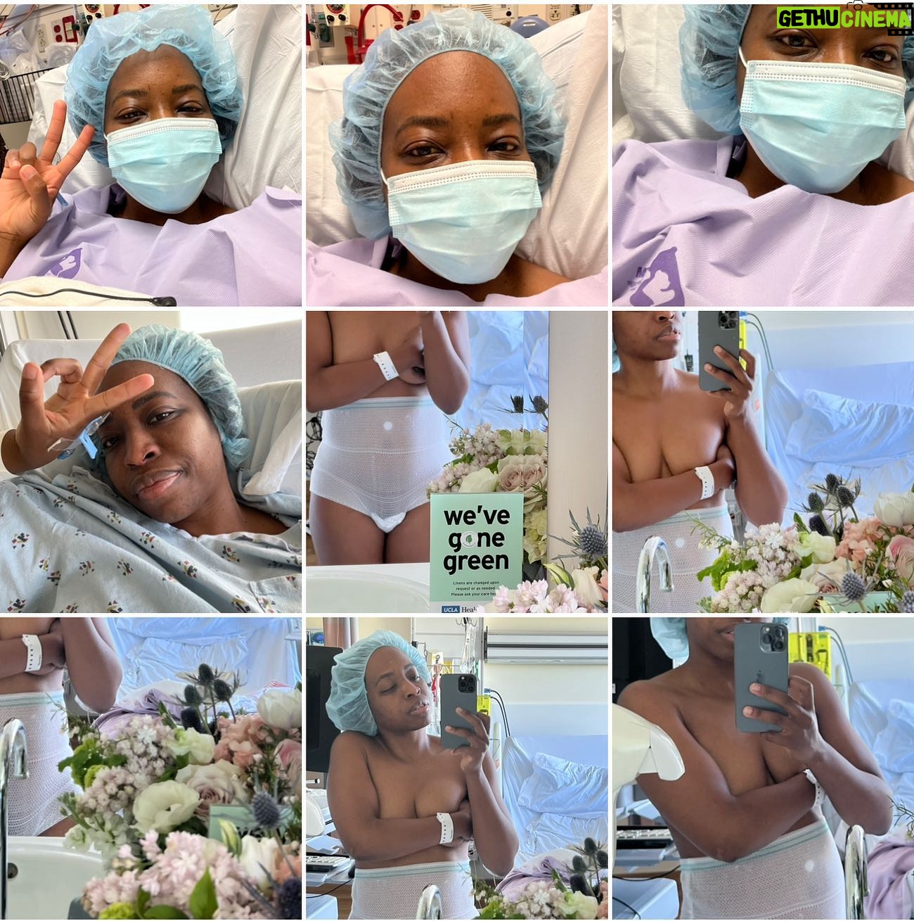 Erica Chidi Cohen - 6.6K Likes - it's been three weeks since my abdominal myomectomy. my team at @uclahealth took amazing care of me and i don't take that for granted, especially as a black woman. they removed 23 fibroids of every shape and size. ⚠️content warning⚠️ if you're not squeamish—swipe through for a closer look. all together my fibroids weighed around 500 grams—approximately the weight of a six-month old fetus.
recovery has been hard. instead of pushing through the pain, i've had to slow down and listen to my body literally demand that i do less. it's been uncomfortable to surrender and face how attached i am to being productive. i've had to rediscover my value outside of the framework of achievement. this forced stillness will be one of my greatest teachers. it's a portal for deep bodily and psychic change—a chance to see everything differently. more on the surgery and recovery process as i continue to heal but today i'm joyful, fibroid-free and finally back at home in my body. #itsallinmygut