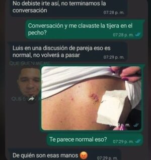 Erika de Sautu Riestra Instagram - LA TOXICA EN 3....2.....1....... PUM !!
Tuvieron relaciones Toxicas?? Y no culpen solo al otro eh ???!!
A: El era el Toxico!
B: Ella era la Toxica!!
C: Ambos Toxicos!
D: Yo soy re Normal
E: Se me pegan
#chats #parejas #toxico