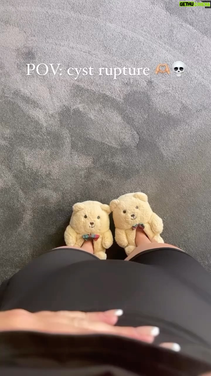 Erin Barnett - 10.3K Likes - No, I’m not pregnant. I can understand why you would think that by just looking at this though.
Unfortunately I’ve had another hemorrhagic cyst rupture, just another day in the life living with PCOS.
The pain that comes with a cyst rupture is horrendous.
What follows afterwards is just as bad…
When the cyst ruptured it released blood and fluid into my lower belly and pelvis. My body will eventually absorb everything, hopefully in the next week. I can manage this pain at home with strong pain medication, heat packs & rest. Because this happens so unexpectedly it can be so frightening if you haven’t experienced this before - I know cyst ruptures are common, but that doesn’t make it any easier when it does occur. In some cases, surgery is needed when this happens.
I absolutely hate my reproductive organs. With only 1 ovary left, I just want it out. That’ll never happen, but I can dream.
I hate this so much. I hate my body for doing this to me. I hate how this makes me feel mentally. I hate everything about PCOS & endometriosis!
Please don’t tell me how you “cured” yours by doing yoga, or how you can cure this naturally. It’s all BS in my eyes & I don’t care. At this point in my life, after everything I’ve been through I’m not open to the idea of doing yoga, drinking some natural tea and getting a massage will magically CURE me. Stop saying something has CURED YOU. THERE IS NO CURE FOR ENDOMETRIOSIS OR PCOS! There may be natural ways to help with your symptoms, but it hasn’t cured you. I literally had someone message me yesterday telling me that pregnancy cures endometriosis & PCOS….. LOL OK.
Sorry if this sounds blunt. I’m exhausted, I’m over this. I don’t want to be a girl anymore lol I know so many other people are going through this, and please know I COMPLETELY UNDERSTAND YOU! I feel for you! I am here for you! 🫶🏼
#pcos #endometriosis #hormones #life #fml #women