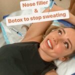 Erin Barnett Instagram - Non surgical rhinoplasty 👃🏼💉🤯 ⁣ ⁣ ⁣ If it wasn’t for @tania.cosmetic.nurse I would have gone with a nose job years ago! Who knew you could get your dream nose with filler/Botox! (Well in my case filler in my nose was all I needed for the nose shape I wanted, this isn’t always the way for others) I just had a small top up on my nose & forehead today. I decided to get Botox in ny armpits to stop me from sweating - I can wear nice tops now without worrying about sweat patches 🫠 ⁣ ⁣ #cosmetics #botox #filler #sweat #humpday #loveit ⁣ ⁣ ⁣ ⁣ ⁣