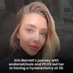Erin Barnett Instagram - After gracing our screens on reality TV Erin Barnett had a battle on her hands… to get doctors to take her seriously. In the latest No Filter podcast episode, Erin shares her difficult journey with Endometriosis and Polycystic Ovary Syndrome, and how she landed on the decision to change her life by getting a hysterectomy despite so many doctors trying to change her mind. . . . #endo #pcos #womenshealth #podcast #nofilter