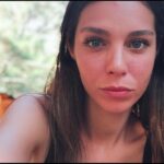 Hazal Adıyaman Instagram – Açık tenliler için kızarma vakti. ☀️🌿🦎