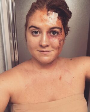 Jaicy Elliot Instagram - It’s been a rough few weeks for Taryn - thank GOD it’s Thursday!!! 🩹🩺 #greysanatomy #greysabc #abcstudios #shondaland