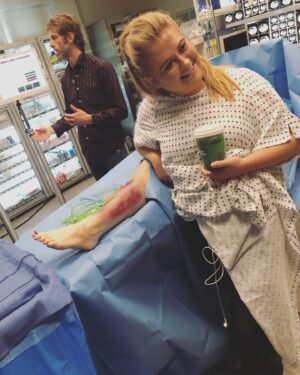 Jaicy Elliot Instagram - My leg and I wish you a wonderful weekend 🌞 #limbsforlife #greysanatomy #abcnetwork #shondaland