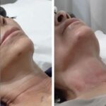 Jasmine Guy Instagram - As you can see, things are going extremely well with my treatments!! I can see the difference in the texture of my skin and it also feels tighter after this treatment. Thank you @prettyfacesatl I can’t wait until my next visit ❤️ #jasmineguy #prettyfacesatlanta