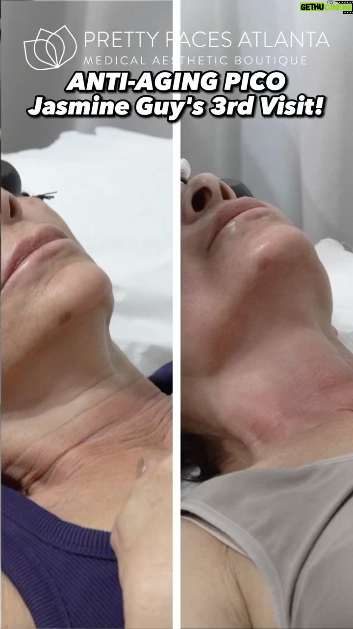 Jasmine Guy Instagram - As you can see, things are going extremely well with my treatments!! I can see the difference in the texture of my skin and it also feels tighter after this treatment. Thank you @prettyfacesatl I can’t wait until my next visit ❤️ #jasmineguy #prettyfacesatlanta