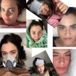 Jennie Jacques Instagram – Humour on better days = medicine. 
Hope on darker days = hard but crucial 💙 
*
I’m LUCKY 🍀 🍀 to see IMPROVEMENT (in my 5th year) & I PROMISE to be a voice for those who don’t recover #MillionsMissing 💥 Watch out world; if I continue to be fortunate, have faith Queen Judy has got your back #pwme 
*
Warriors  #LongCovid #mecfs #LymeDisease #POTS are truly inspirational 💥 
*
I saw @thephysicsgirl tweet 🐣 This illness is criminally underfunded & even mild #mecfs can be horrendous. Please 🙏 have empathy & compassion for #pwME #LongCovid & bake for @bake4mecfs if you can! We have COLLAB bakers for those who are limited but want to be involved!
*
 Photos can’t quite show the horrific moments/hours/days/weeks 
(sometimes years & decades!) 
painfully endured by #pwme
& these pics (of course!) do not reflect it 🙃 
Look up #severeme for perspective…
Mild-moderate crashes can also be life-altering & terrifying
FUND THE SCIENCE 🧬 🧪