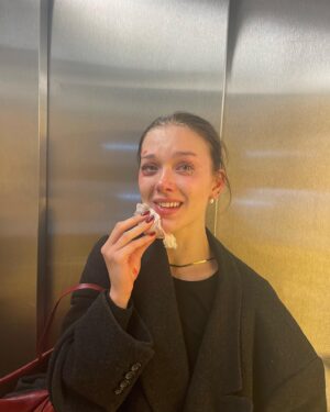 Jessica Alexander Instagram - gna keep it real Vienna was great but I also face planted off a lime scooter and got stitches 🫶🏼 so in the interest of transparency plz enjoy these pics of me serving with a face wound. & in the words of Alfred Pennyworth, why do we fall Bruce? So we can learn to pick ourselves up 🤝🏼🫡