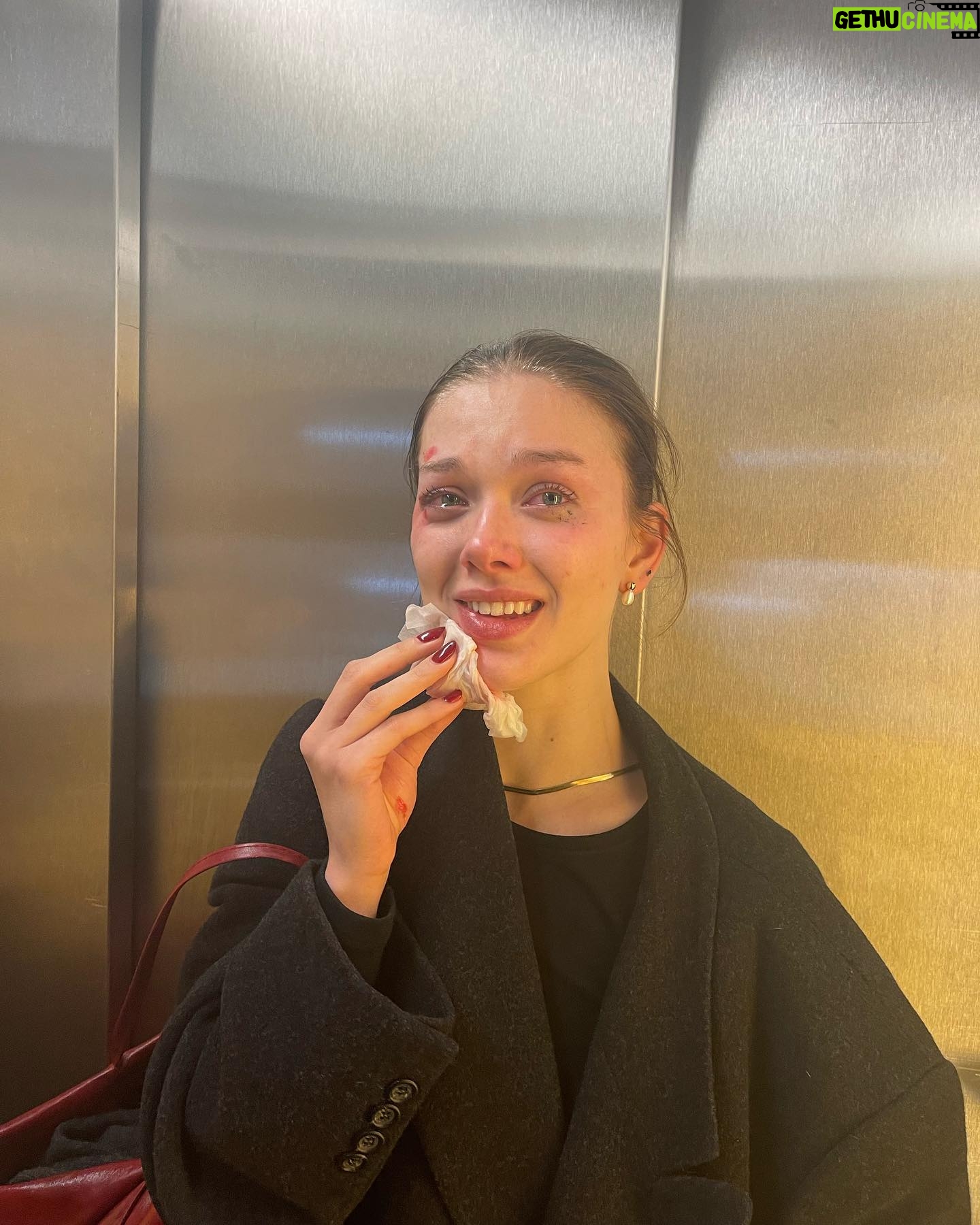 Jessica Alexander - 66.1K Likes - gna keep it real Vienna was great but I also face planted off a lime scooter and got stitches 🫶🏼 so in the interest of transparency plz enjoy these pics of me serving with a face wound. & in the words of Alfred Pennyworth, why do we fall Bruce? So we can learn to pick ourselves up 🤝🏼🫡