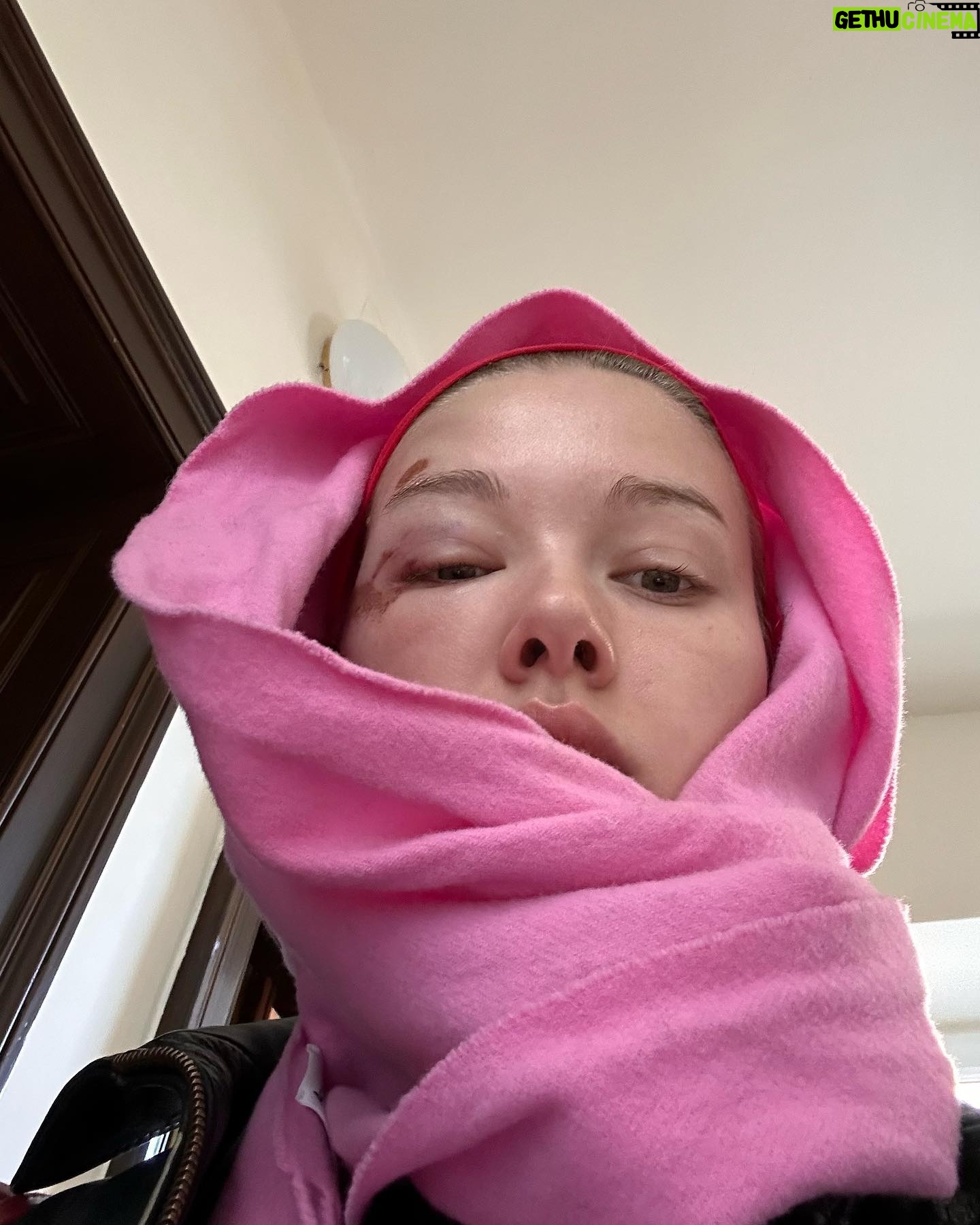 Jessica Alexander - 66.1K Likes - gna keep it real Vienna was great but I also face planted off a lime scooter and got stitches 🫶🏼 so in the interest of transparency plz enjoy these pics of me serving with a face wound. & in the words of Alfred Pennyworth, why do we fall Bruce? So we can learn to pick ourselves up 🤝🏼🫡