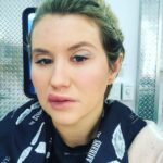Jillian Bell Instagram - Allergy season ***I did not actually have an allergic reaction, just a great makeup team on Godmothered!! Sorry if I worried y’all ❤️👄