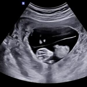 Johanna Puhakka Instagram - Joskus toiveet voi käydä toteen isommin kuin uskaltaa edes haaveilla, meitä on ens kesänä NELJÄ!!!! ✨
Twin babies are on their way👶🏼👶🏼❤️❤️❤️