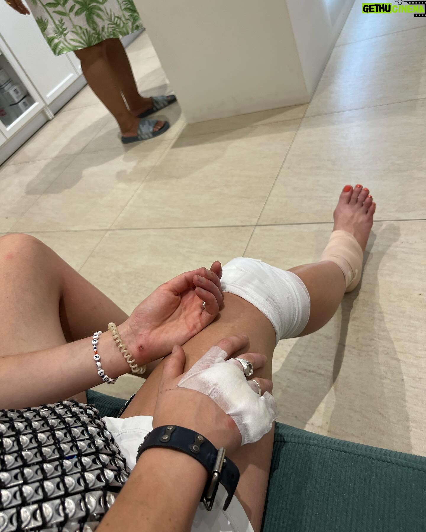 Julia Wulf Instagram - Ramponierte Sau statt rampensau- Thailand du hast mich wahrlich aussenander genommen. Angefangen mit ner 5 h verspäteten Ankunft mit 10 minütigen Ohnmachtsanfall mitten in der Luft im Flugzeug vor den Toiletten, Gepäck für 149€ am Airport dazu buchen müssen damit es dann 7 Tage VERSPÄTET ankommt, in der Zeit 2 Flüge verpasst, Kreditkarte verloren, mein Pass fast abgelaufen, dann mit dem Scooter auf Sand weggerutscht und nen Unfall gehabt mit EXTREMEN Schmerzen und Antibiotika jetzt, 3 Riesen Beulen am Kopf weil ich zu groß bin für die Architektur und mich ständig stoße aufgrund des humpelns, dann ist mir gestern noch EINFACH SO so mein Handy kaputt gegangen und ich habe für 400€!! Ein iPhone 12 gekauft um dann rauszufindenden, dass es nur 84% Akku stärke hat und man merkt es. Stark. Zu letzt dann heute noch die deutsche Simkarte verloren mit der ich E-Mail, WhatsApp, Bank…aktivieren könnte. Könnte.. ja. Zu guter letzt noch nen miesen blähbauch wegen der Antibiotika aber hey! MORGEN BALI ODER WAASSSS LETS GETTID und ein großes KOORB UNN KA an Thailand. Es war mir ein Fest DEGGAAAAH 🤙🏻🤙🏻🤙🏻🤙🏻🤙🏻🤙🏻🤙🏻🤙🏻 ** Nachtrag: kann nicht nach Bali fliegen weil der pass keine 6 Monate mehr gültig ist, ich hab ehrlich total Fieber bekommen (glaube wegen der Antibiotika) und super dollen Husten eh seit Tagen, UND DANN NOCH MEINE TAGE und unterbleibkrämpfe hahahaahh fliege jetzt nach Bangkok (alleine) und dann..mal sehen