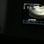 Juliana Harkavy Instagram - The fertility journey continues!!! 🍍✨ Second surgery in a month (15th procedure in total??) Biiiig hug to anyone else going through this. 🫂💞 Hubby and I are on year 4 of this whirlwind 🤯 and by far, one of the most unexpected and welcomed outcomes of the process has been learning to be a mother ✨to myself.✨ A concept I'd never really even considered, let alone practiced until recently. Holding myself with unconditional love, compassion, softness, strength, and acceptance was somewhat foreign to me in the past. What an incredible and necessary discovery to make before mothering a child. I am more resilient, brave, self-knowing, solid in my marriage, authentic, loving, and trusting in the universe than I was when this all began. I let go of all expectations for motherhood to look a certain way or come at a certain time. This opened a pathway to peace. With the help of weekly therapy (@a_verybritishlesbian ), the fertility community, amazing doctors (@fertilitygodmother @siedhoff ), and an incredible personal support system I'm so blessed to have (👑 @eskandar_alexander and more- you know who you are), I've developed total faith that if we're meant to guide a soul through this life, we will- however & whenever it's meant to happen. I am so grateful for the challenges, because without them I would not be this unrecognizable version of myself- someone who I've never been prouder of, or taken better care of. If this is your journey too, please know that the universe supports you infinitely- it just sometimes has a funny way of showing it. But don't ever lose hope. Especially when you don't get what you want in the moment. Trust. Everything is going to be okay. I promise. You are not alone. 🪽🤍🪽 #fertility #fertilityjourney #fertilitytreatment #endometriosis #endoawareness #fibroidawareness #lowamh #infertilitysupport #infertilityawareness #infertilitywarrior #infertilityhope #ivf #ivfwarrior #ivfcommunity #ivfsupport #ivftreatment #ivfhumor #marriagegoals #motherhood #wellnessjourney #mentalhealthsupport #godsplannotmine #faithinspired #iui #hysteroscopy #laproscopicsurgery #fertilityhelp #lightinthedarkness #positivevibes #motherhoodjourney