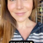 Julie Benz Instagram – Follow along as I tried out the new FDA approved treatment #trilift at @brilliancedermatology with my personal skin guru Jasmine Khachatrian, PA (she’s a Dermatology Physician Associate with 20  yrs of experience 🌟) TriLift is a three layered procedure that utilizes Dynamic Muscle Stimulation, Tripollar RF and TRIFX (radiofrequency microneedling) These three treatments target structure, contour and texture with very little to no downtime! What I love about this procedure is it’s a mighty,  noninvasive multi-tasker with immediate real results!!! And Jasmine is the 💣