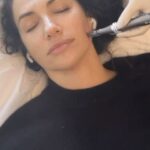 Kate Siegel Instagram - The magical touch of Lauren at @julianaclinics makes this skin possible. Here’s a rundown of my treatments from this session: • Ultherapy (full face) • Microneedling w/ stem cells (mesenchymal stem cells) • Botox facial • Skinvive (injected microdroplets of hyaluronic acid) *Experience is shared In partnership with @julianaclinics *