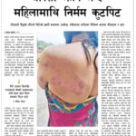 Keki Adhikari Instagram - यो आजको समाचार । अहिले पनि हामी यस्तो समाचार देखिराछौँ , पढिराछौँ । सोच्नुस् त भोग्नेलाई के होला ? सोच्न सम्म नि सकिन्न । हाम्रो मस्तिष्कमा एउटा घर दिएका छौँ हामी आफैले यस्ता अन्धविश्वासलाई । त्यसलाई जग बाटै भत्काउन तपाईं हामी सबैले आफ्नो भुमिका खेल्नुपर्छ । हामी सबै यही समाजको उपज हौं । आफ्नो तर्फबाट जे गर्न सकिन्छ गरौं । अपराधी नछुटोस् र यस्तो अमानवीय क्रुर घटना कहिले नघटोस् ।