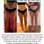 Kelly Helard Instagram – Vous l’avez compris, j’ai repris une activité à temps plein entant que Community manager en cdd et je l’espère en cdi dès septembre. 
J’ai réalisé une vidéo qui explique mes missions .
J’ai voulu vous l’annoncer mais je ne parlerais pas forcément de mon travail ici car je partage ma vie sur cette Instagram que ce soit activités avec mes enfants ou les tournages de mamans et célèbres ou encore mon sport mon alimentation …. Et pleins d’autres choses . 
Par contre je parlerais de la maladie sur le compte : @lipoedeme.france je rappelle que c’est une maladie qui est reconnue par l’OMS dont beaucoup trop de femmes souffrent . Ce n’est pas de l esthétique mais bien une maladie  avec de réelles douleurs.
