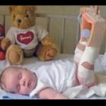 Kerry Ingram Instagram - Happy wishbone day! Today is the day we wear yellow to raise awareness for #OsteogenesisImperfecta, a genetic condition I was born with that causes bones to break easily along with many other side effects and challenges. The third picture is of me at 6 weeks old. There wasn’t much information on OI at the time, which led to my mum being accused of abuse before someone familiar with the symptoms recognised it and had a diagnosis. Doctors at this point had no idea which type I had either and all they said was “it can be fatal, if not she probably won’t be able to walk” well I’m still here and walking! (Maybe even skipping if I’m feeling boujee) - which is thanks to the miracle that is modern medicine (not yoga, like someone on Instagram suggested... or milk, like someone on twitter suggested) - yikes🤦🏼‍♀️ Sending love to all my OI fam 💛 #wishboneday