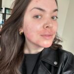 Khate Lessard Instagram – Un peu de vrais dans votre feed🫶🏻 4ieme traitement de laser aujourd’hui!! Mes traitements de laser avancent,j’ai maintenant mes cheveux naturels,je commence ma 3ieme semaine d’antidépresseur et je continue de garder ma forme.J’avais besoins de me détacher de certains artifices pour mieux me recentrer et avoir le plus possible le contrôle sur mon quotidien et la maladie qui est entrer dans ma famille.Quand les temps sont pas faciles…il faut choisir ses priorités et demander de l’aide💕