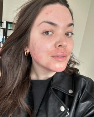 Khate Lessard Instagram - Un peu de vrais dans votre feed🫶🏻 4ieme traitement de laser aujourd’hui!! Mes traitements de laser avancent,j’ai maintenant mes cheveux naturels,je commence ma 3ieme semaine d’antidépresseur et je continue de garder ma forme.J’avais besoins de me détacher de certains artifices pour mieux me recentrer et avoir le plus possible le contrôle sur mon quotidien et la maladie qui est entrer dans ma famille.Quand les temps sont pas faciles…il faut choisir ses priorités et demander de l’aide💕