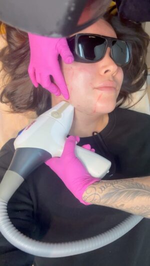 Khate Lessard Instagram - Juste parce-que c’est ma plus grande insécurité….je post ça ici.Une des plus grosses partie de ma disphorie,c’est les poils….mais au finale…c’est juste des poils.On me reproche souvent de trop mettre de maquillage.Don’t get me wrong,J’ADORE le maquillage mais reste que c’est l’armure que j’ai choisie en début de transition.Aujourd’hui j’ai une relation beaucoup plus saine avec le maquillage mais je struggle énormément avec des détails comme la pilosité et toute choses qui donnerait raison à quelqu’un de trouver une faille et d’affirmer que je ne suis pas tant « femme » que ça finalement.Pour certains ça peu avoir l’air de rien mais…j’apprend encore aujourd’hui à sortir de chez moi sans maquillage.J’ai recommencer le laser et j’ai repousser,repousser le moment par peur d’être juger par la personne qui allais faire mon traitement.J’avais pas envie non plus de revivre l’inconfort de faire face à mon propre struggle.WELL…je suis allée au gym cette semaine sans makeup et j’en suis bien fière HIHI! @fabrice_107 m’a encourager à partager sur le sujet et je le remercie d’être un aussi bonnnn copain qui me trouve belle peu importe🩷

Désolé pour les fautes et les phrase probablement mal écrites,c’est un message écrit sur le moment même et sortie tout droit du coeur🫶🏻