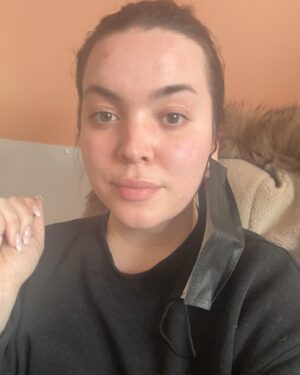 Khate Lessard Instagram - Un peu de vrais dans votre feed🫶🏻 4ieme traitement de laser aujourd’hui!! Mes traitements de laser avancent,j’ai maintenant mes cheveux naturels,je commence ma 3ieme semaine d’antidépresseur et je continue de garder ma forme.J’avais besoins de me détacher de certains artifices pour mieux me recentrer et avoir le plus possible le contrôle sur mon quotidien et la maladie qui est entrer dans ma famille.Quand les temps sont pas faciles…il faut choisir ses priorités et demander de l’aide💕