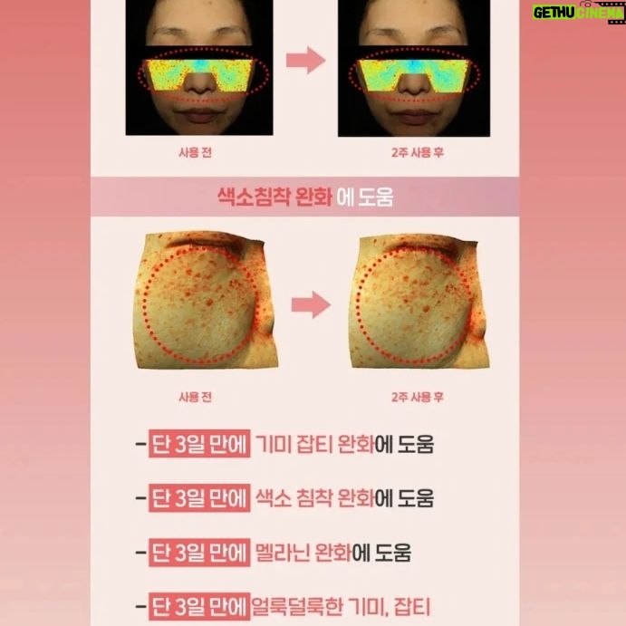 Kim Ji-hye Instagram - 나노입자 콜라겐실을 3초만에~~신기하다👀 . 다루기 힘든 콜라겐실 . 오롯이 얼굴에 올릴수있는~~신개념 콜라겐 비타 마스크 . 3초면~끝 . 리프팅👍 . 기미 잡티👍 . 탄력👍 . 피부보습👍 . 3일만에 변화를 주는 강력한 콜라겐 비타 마스크 . 대박👏👏👏👏 .