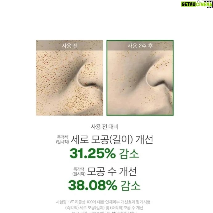 Kim Ji-hye Instagram - 리들샷 100~300~700 중독이야 . 약한거 말고 . 내피부를 확실히 변화시켜주는~~~ . 나이들수록 각질탈락 안되고 . 느려지는 피부재생 주기 ㅜㅜ . 리들샷으로~~관리해 보아요~~