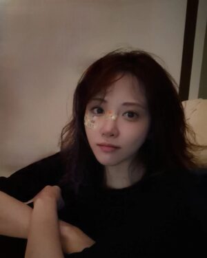 Kim Min-ah Instagram - 자빠져서 다쳤습니다 죄송합니다 19일 탁스패치에서 만나요
#지금은 #다나았어요
