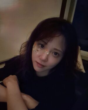 Kim Min-ah Instagram - 자빠져서 다쳤습니다 죄송합니다 19일 탁스패치에서 만나요
#지금은 #다나았어요