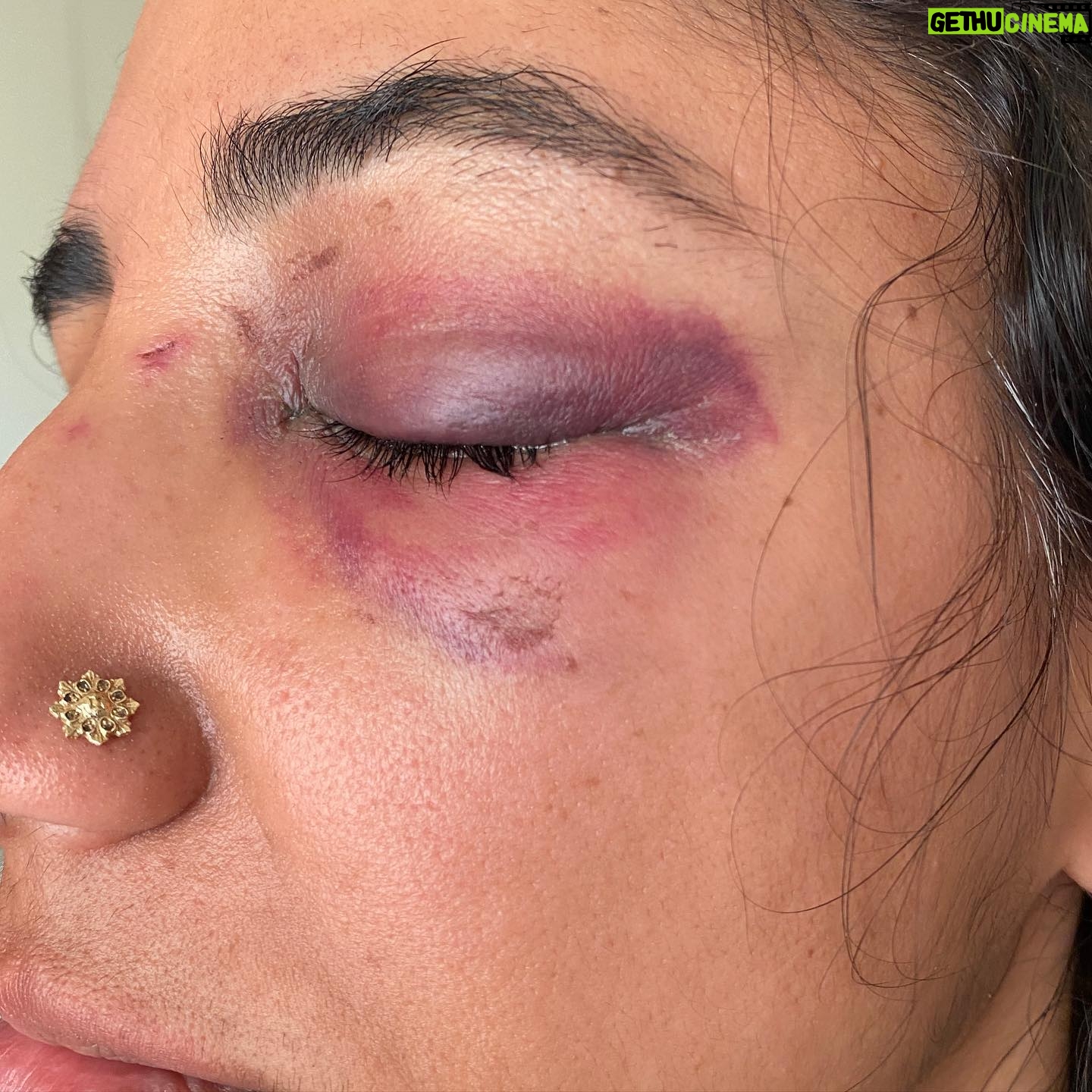 Kiran Deol - 11.5K Likes - TW: Assault
Friends. I normally try to keep it light on here. But Friday night I was attacked unprovoked, by a random man outside a 7-11 when walking back from @lolowinebar with my friend @ericafishman. Super scary.
People have been asking if it was a hate crime? I’m not sure. I was the only brown person around and he was a white dude. But he also seemed unwell.
Police apprehended him; @ericafishman was amazing, doctors have been awesome, and even though LA gets a bad wrap, a bunch of strangers got me ice were super kind and helpful.
Im still shaken and processing. I have fractures and need some surgery as a result. The status of how long this will take is unknown atm. So as you go about your holidays, please stay safe and be vigilant.
Now if you see me wearing sunglasses at night, you know why.
Finally, in true comedian fashion, please swipe for three ‘lewks.’ Nude, pirate, and diva. You know what app you're on.
Also, nbd, but I got a shoutout on the Citizen app as ‘woman.’ Pretty chic.
Take care this holiday season. I love you. 💗