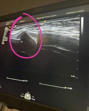 Leah McCourt Instagram - Would say January & February dump but the first two months have felt like two years.  Sitting in reception of @kingsbridgeprivatehospital waiting to get another scan thinking wow what has went on this year … the last few weeks since being back home and injured have just been hospital visits and good friends keeping each other positive. 
 
Exciting opportunities coming up and looking forward to making this a special year regardless of everything that has happened to us. 

Thank you to everyone for their continued support and messages for Ryan & @emzac_, Ryan is the most mentally tough person I have ever met and his mindset and attitude is beyond inspiring. 

Swipe to see scan from tonight, the pain has gone down and I can finally sleep but still a few weeks away from any training and praying it will heal with no surgery.  I trust Gods plan & timing and will be back fighting asap.  It’s been a good reminder it’s ok to slow down and be there when your people need you.  Every season has a reason ❤️