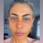 Leyla Bilginel Instagram – GOJİ BERRY MASKESİ! Bir Leyla Bilginel ürünüdür! İçeriğinde koruyucu olmadığı için muhakkak buzdolabında korumalısınız! 
48 yaşındayım ve hiç bir işlem yok yüzümde. Maskemi düzenli kullanan her can aynı sonucu alıyor! Daha fazlasını görmek için lütfen @leylabilginelshop SAYFASINI takibe alın ve inceleyin! 
❗️Cildin nem dengesini düzenler..
❗️Ciltleki lekeleri yok eder.
❗️Siyah noktaları temizler.
❗️Sivilce ve aknelere iyi gelir. İzleri yok eder. 
❗️Göz altı morluğu ve göz kapağı düşmesini önler!
❗️Sarkık ciltleri toparlar cildi sıkılaştırır! 
❗️Kaz ayağı çizgilerini soldurur! 
❗️Cilt rengini eşitler!
❗️ Cilde ışıltı ve parlaklık kazandır! 
❗️Roza türü rahatsızlıklara iyi gelir!