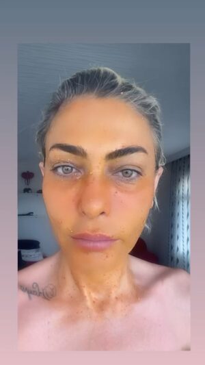 Leyla Bilginel Instagram - GOJİ BERRY MASKESİ! Bir Leyla Bilginel ürünüdür! İçeriğinde koruyucu olmadığı için muhakkak buzdolabında korumalısınız! 
48 yaşındayım ve hiç bir işlem yok yüzümde. Maskemi düzenli kullanan her can aynı sonucu alıyor! Daha fazlasını görmek için lütfen @leylabilginelshop SAYFASINI takibe alın ve inceleyin! 
❗️Cildin nem dengesini düzenler..
❗️Ciltleki lekeleri yok eder.
❗️Siyah noktaları temizler.
❗️Sivilce ve aknelere iyi gelir. İzleri yok eder. 
❗️Göz altı morluğu ve göz kapağı düşmesini önler!
❗️Sarkık ciltleri toparlar cildi sıkılaştırır! 
❗️Kaz ayağı çizgilerini soldurur! 
❗️Cilt rengini eşitler!
❗️ Cilde ışıltı ve parlaklık kazandır! 
❗️Roza türü rahatsızlıklara iyi gelir!