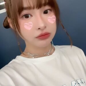 Lin Hana Instagram - 上次跟大家分享的鳳凰🐦‍🔥🐦‍🔥一個月後的before/after
每個人看完都超！級！心！動！的！真的非常推薦！
😝這篇是三個月後惹😝
朋友已經約這個禮拜打完了！除了痛，忍忍就過了！
先打就先漂亮囉寶寶綿😝
雖然價錢不便宜，不過一般人如果沒有像模特兒每天要拍照表情喜怒哀樂做個三千回以上外加外拍艷陽曬的！可以撐個1.5～2年是非常划算的療程喔！隨著膠原蛋白增生，大約三到六個月效果會最明顯！
可以給大家參考！我自己大約一個月就蠻有感的😁鳳凰老手4我🤪
除了輪廓線加強，年紀增長脖紋也不會給你少長，人家說看年紀就看脖子！ok～～醫生麻煩也幫我加強一下脖子！謝謝😚
看我的臉整個小一號好像瘦了4公斤但其實沒有！
就只是下垂亂降落ㄉ肉肉們回家歸位變緊實了！
我是給 @iskinbeautyclinic 王麒惠醫師治療的~
可以直接打電話到診所預約諮詢唷！護士都超漂亮😜
以上給各位水水們參考💕💕💕