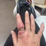 Loana Petrucciani Instagram – Ça c’était  avant l’opération 😱 😰 loana #beauty ##frenchgirl #miroir #naturalmakeup #loveyou #influenceuse #romantic #women #selfie #love #heart #sweet #friends #blondebombshell  #love #heart #sweet #friends #blondebombshell #🧡