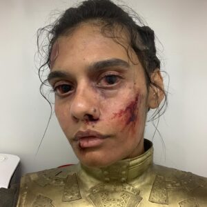 Madeleine Madden Instagram - Thank you to everyone for your overwhelming love and support this season, I have felt every bit of it and it has meant so much. 

I want to thank @rammyparktv for her exceptional quality of work on episode 6, for bringing me to tears and giving me an episode an actor dreams of. 

Maja Vrvilo for nurturing me and trusting in my process.

@davinajl and @sharon_gilham_costume_design and their incredible teams for their immaculate work, attention to detail and for being in the trenches with me every day. 

Scarlett MacKim our movement coach, who majorly supported me and fleshed out our vision. 

 @xeliamj for bringing the light when days felt dark and being an incredible partner on screen. And the creator of slide 2. 

And finally, the remainder of my cast and crew who have become family and have dedicated their lives and soul to this show. 

#Egwene #TheWheelofTime